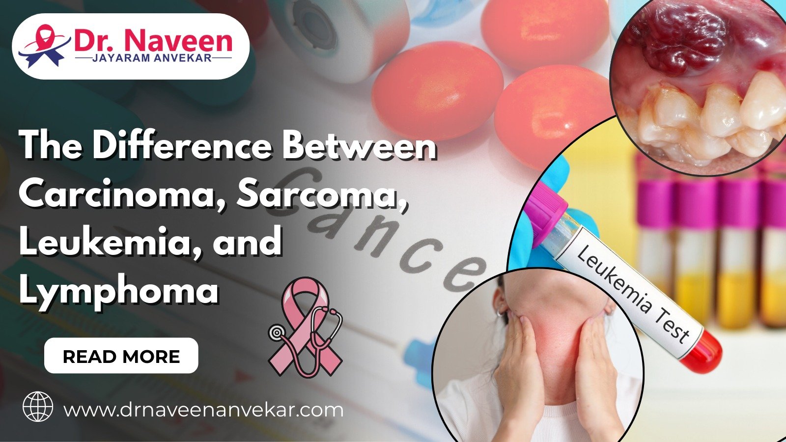 Understanding Cancer Types: Carcinoma vs Sarcoma vs Leukemia vs Lymphoma